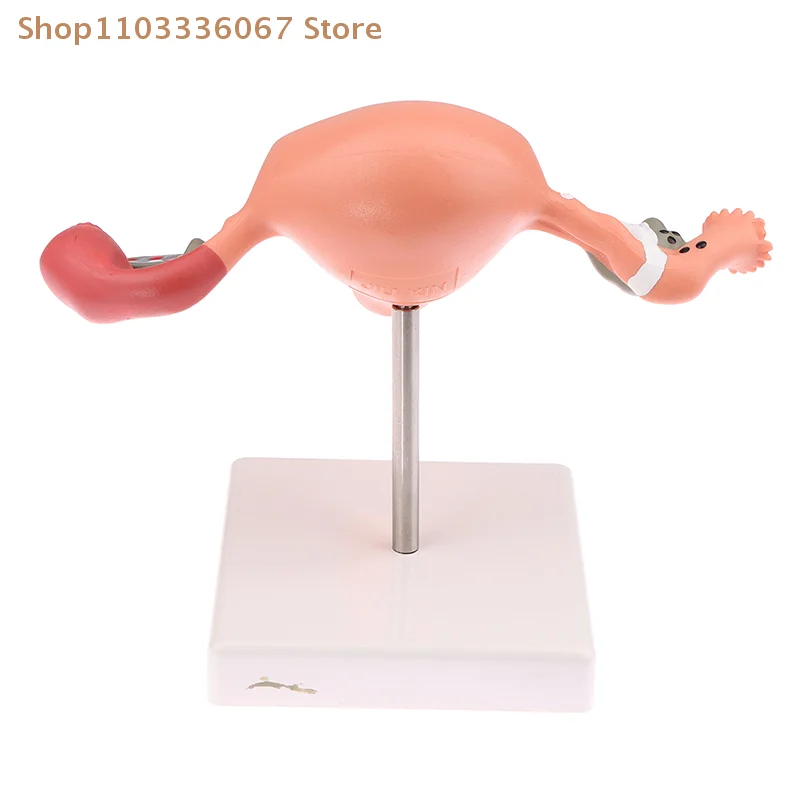 [Y]1Pcs Medical Props Model Pathological Uterus Ovary Anatomical Model Anatomy Cross Section Study Tool