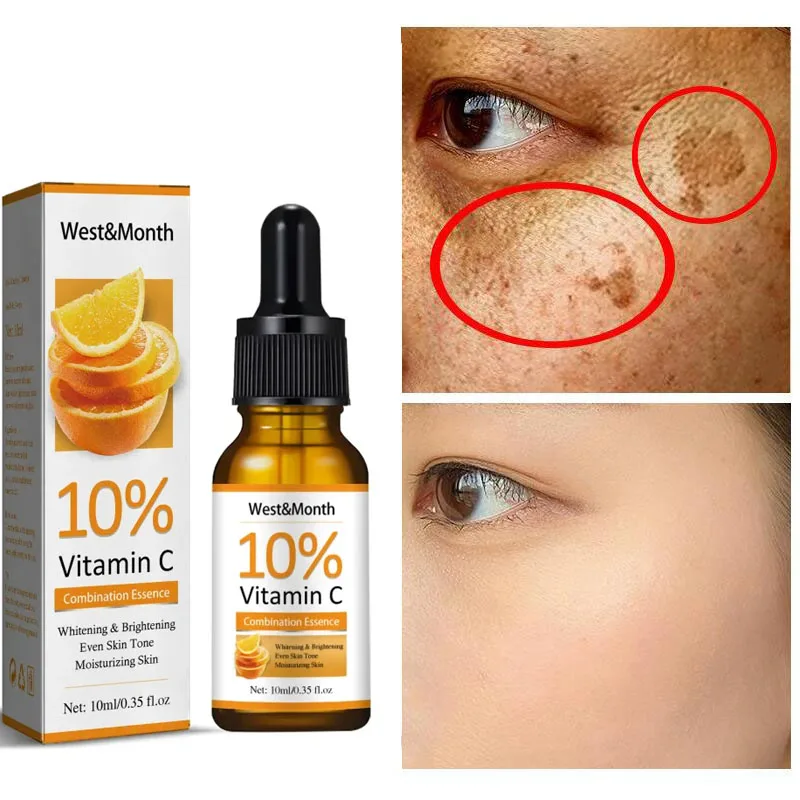 Serum pemutih wajah Vitamin C, produk perawatan kulit Korea Anti oksidasi, Serum Wajah penghilang bintik hitam asam Hyaluronic, Serum pemutih wajah