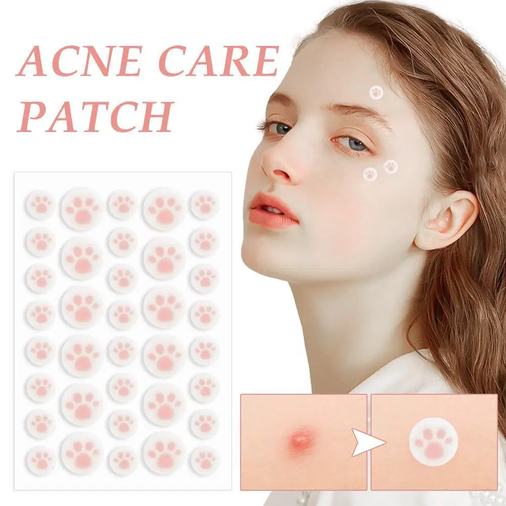 36pcs Hydrocolloid Acne Pimple Patch น่ารัก Cat Paws รูปสิวดูดซับฝาครอบ Patch ที่มองไม่เห็นสําหรับสิวจุดสาวความงาม