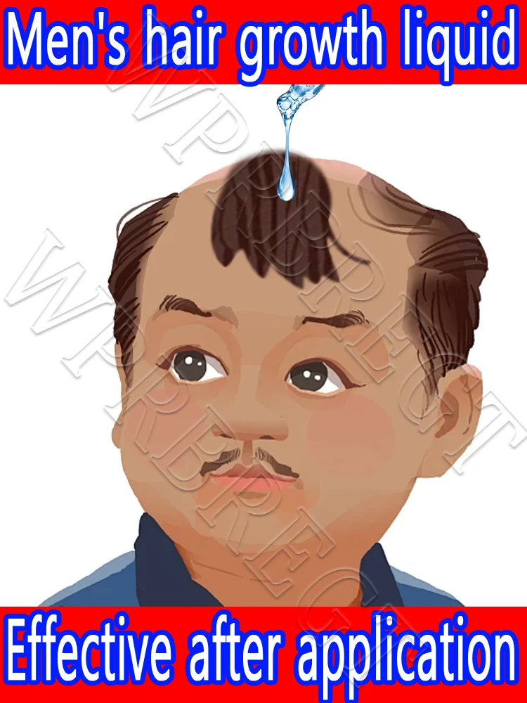 

The top of the head is full of hair,No need for hair transplantation