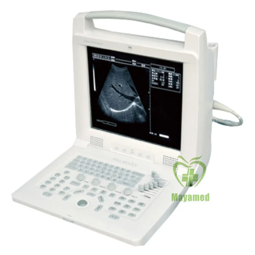 

MY-A005A Digital System Equipment 2D 3D Human Veterinary USG Color Doppler Price Ultrasound Machine Portable Ultrasound Scanner