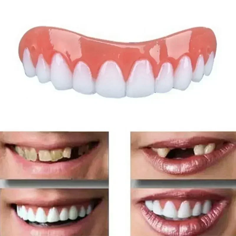 Neue künstliche Zähne aus Silikon, obere und untere Veneers, perfektes Lachen, Zahnprothesen, bequeme Passform, Zahnpflege.