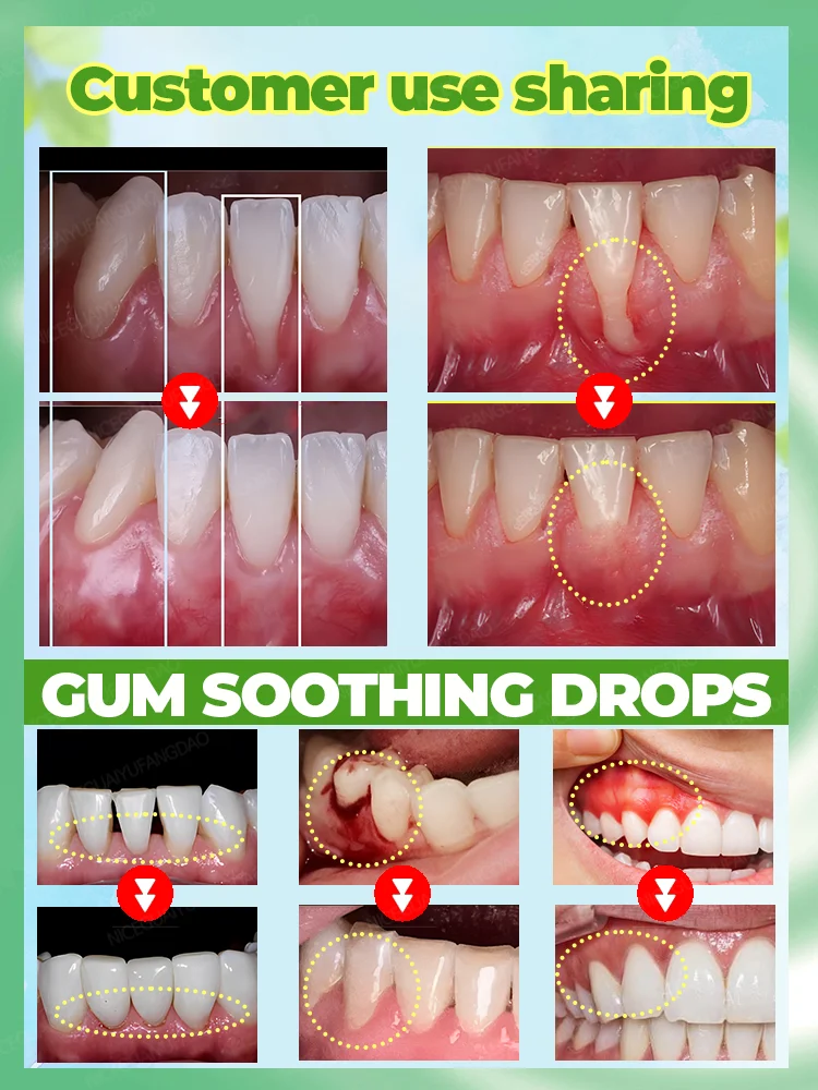 Gum Soothing Drops, repair gum recession, relieve gum bleeding and tooth pain