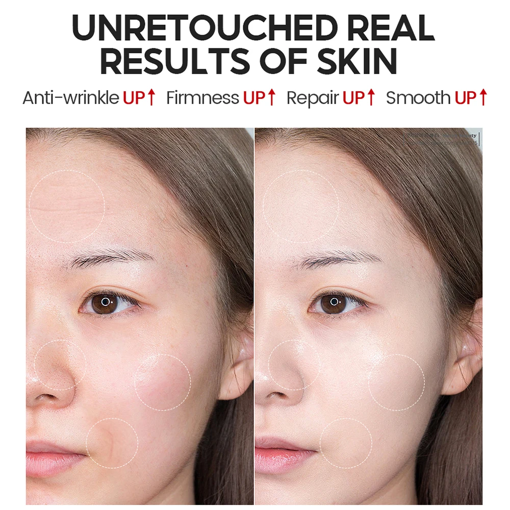 100g Anti Aging Retinol Sleeping Mask Face Cream Replenish Moisturizing Removal Fine Lines Wrinkles Facial Mask Korean Cosmetics