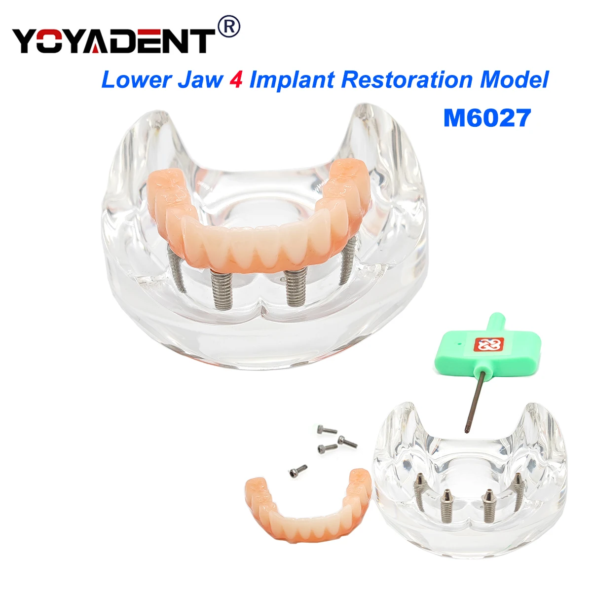 Dental Model simulation Teeth Model Lower Jaw Implant Restoration 4 Screws with Post Core Bridge Dentist Teaching Studying Demo