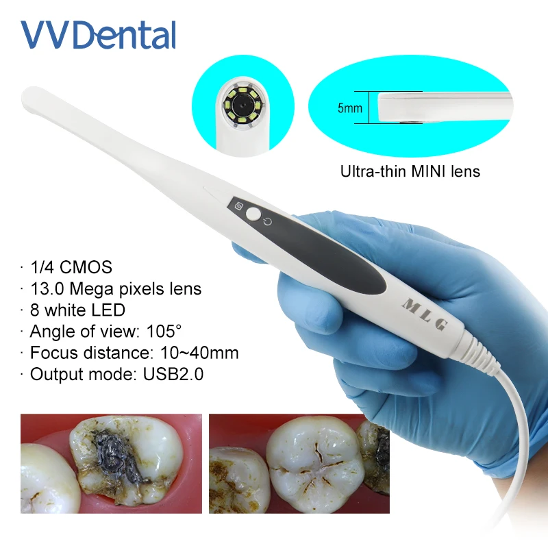 Ultra-Thin 5mm Dental Intraoral Camera with 8 White LED MINI Lens HD 13.0 Mega Pixel Computer USB Oral Imaging for Lab Equipment