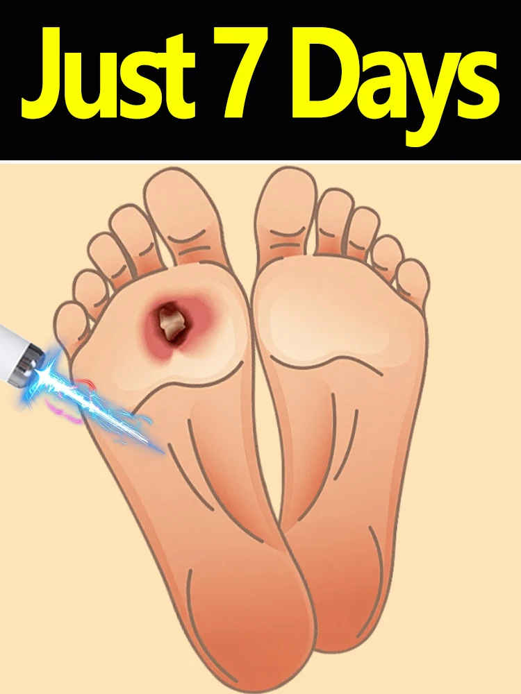 

Инструменты для ухода за ногами, подходящие для ежедневного использования, отшелушивающая лазерная ручка, новейшая бестселлерная лазерная указка.