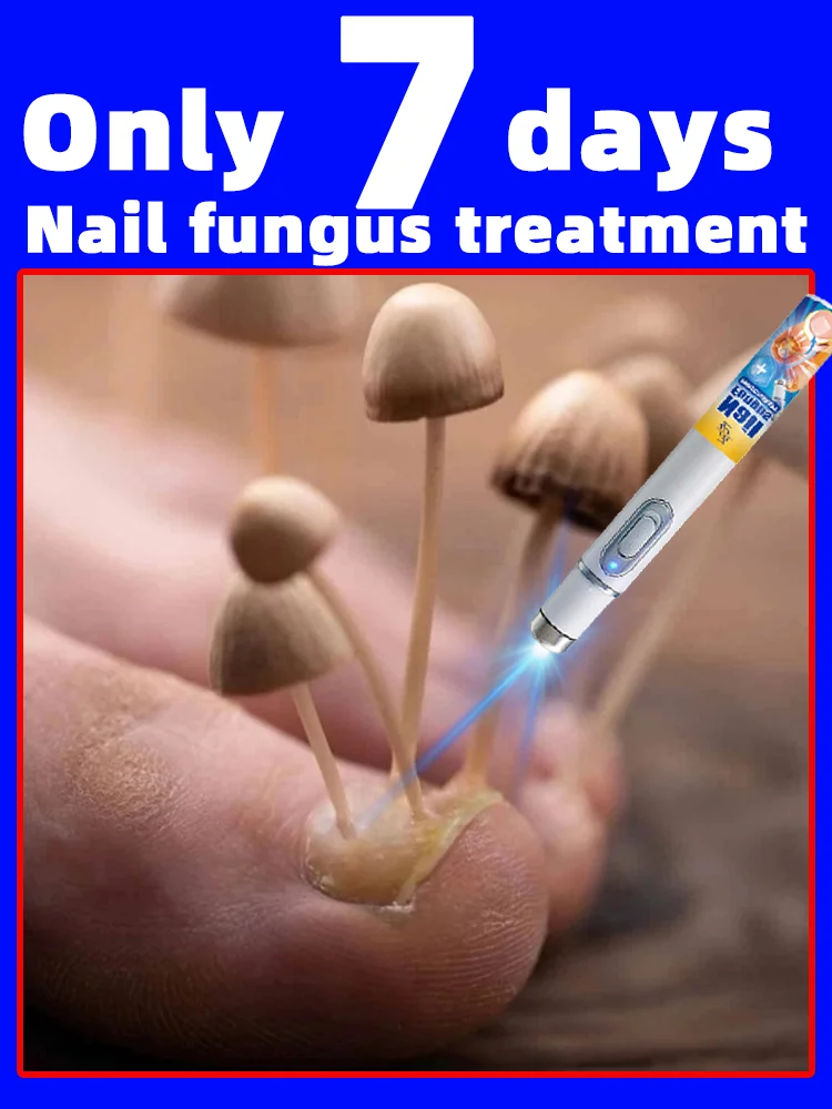 

Nᴀɪʟ Fᴜɴɢᴜs Tʀᴇᴀᴛᴍᴇɴᴛ, Nᴀɪʟ Fᴜɴɢᴜs Rᴇᴍᴏᴠᴀʟ