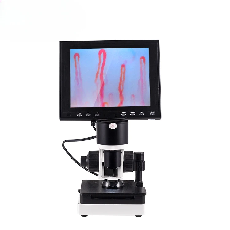 Vascular fluid Capillary Microcirculation Xw880, High Quality Microcirculation Test Machine