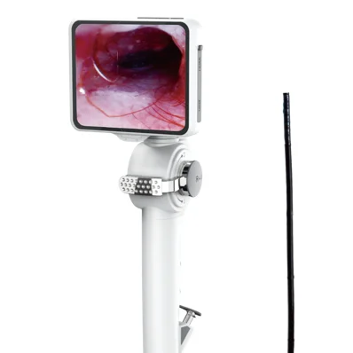 Medical hospital and veterinary 2.8mm/3.8/4.8mm portable video ENT Flexible endoscope