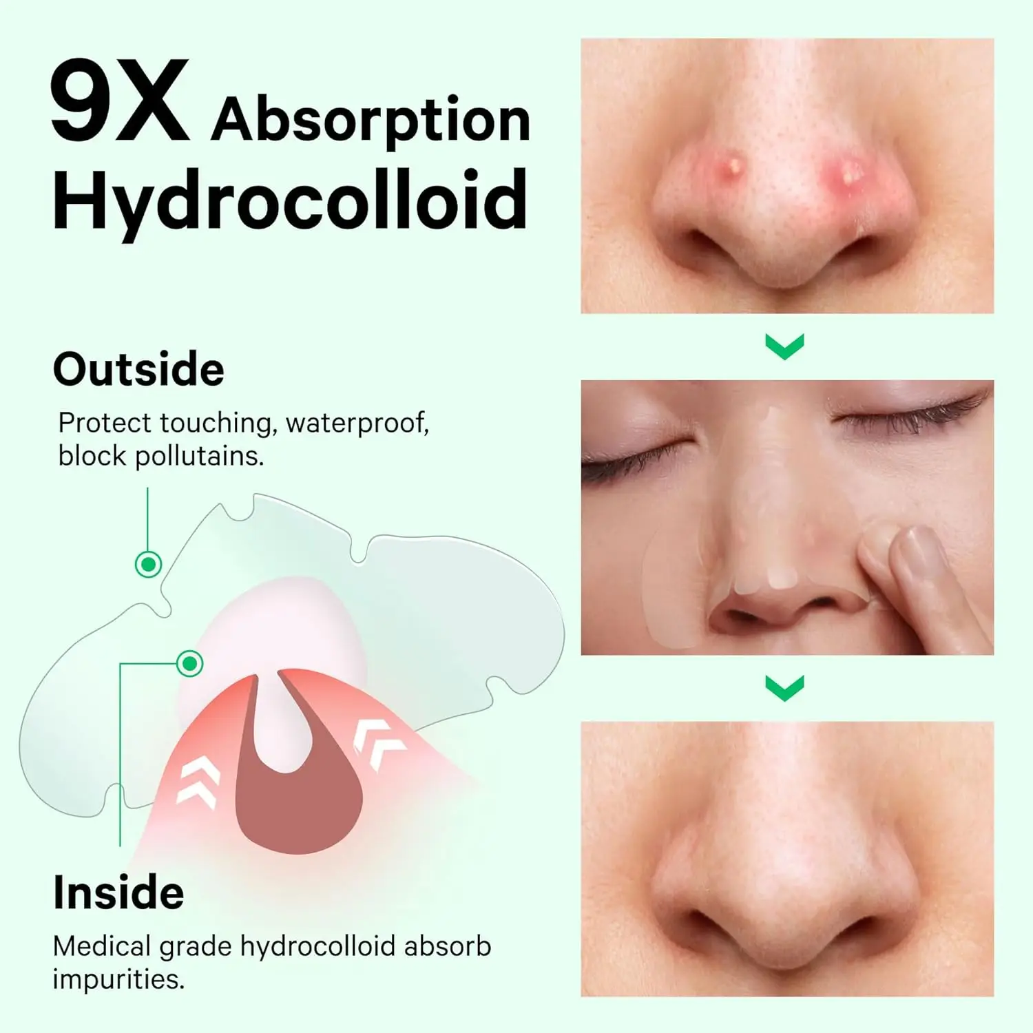 10 Count Patches for Nose Overnight Acne Pore Strips Hydrocolloid Nose Patches Control Oil Targets Pimples Blemishes Clear Skin