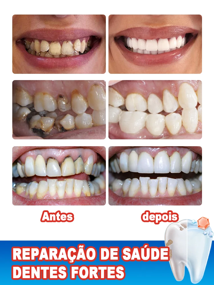 Brushing teeth, repairing cavities and removing yellowing