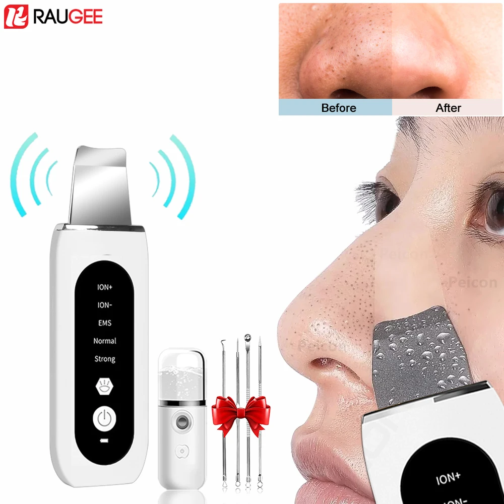 Épurateur de peau à ultrasons, nettoyeur de pores d'acné, dissolvant de points noirs, livres de visage en profondeur, nettoyeur de pelle qualifiée ale