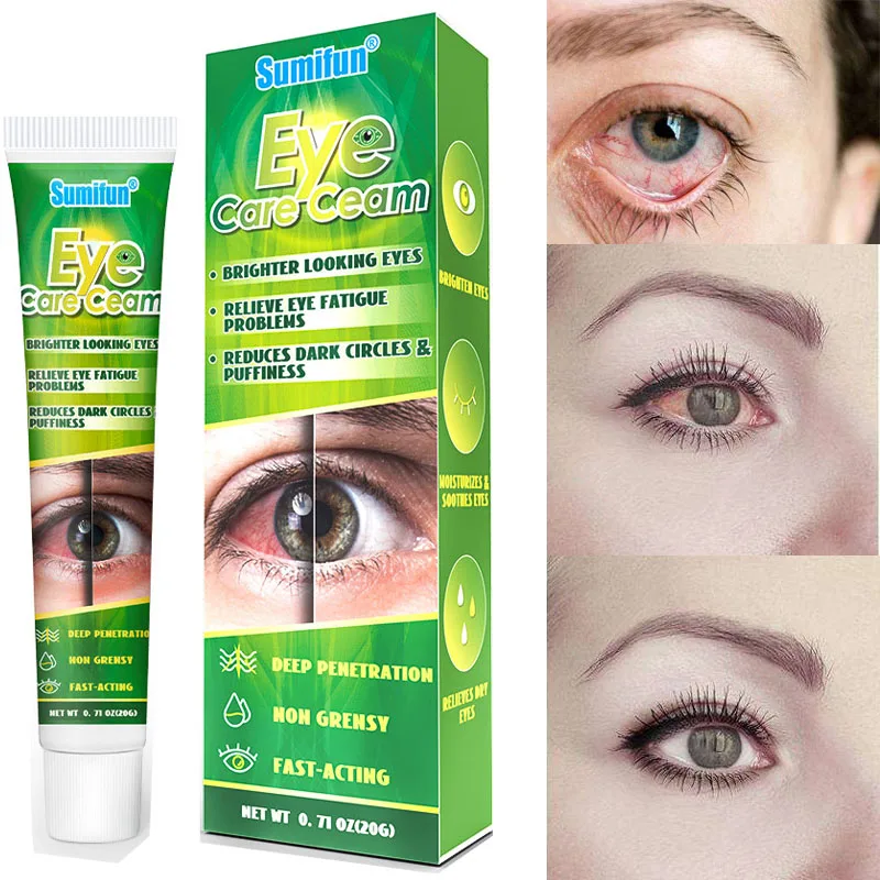 Chinese Herbal Medicine Eye Care Cream Brighter Looking Eyes Relieve Eye Fatigue Problems Reduces Dark Circles And Puffiness