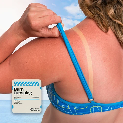 Imagen 2 del producto Gel para el cuidado de quemaduras de emergencia, crema calmante refrescante para aliviar las quemaduras solares, comodidad instantánea para quemaduras