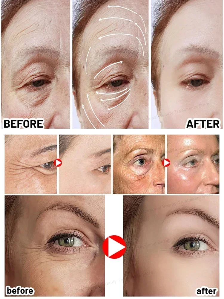 Wrinkles disappear Become beautiful now