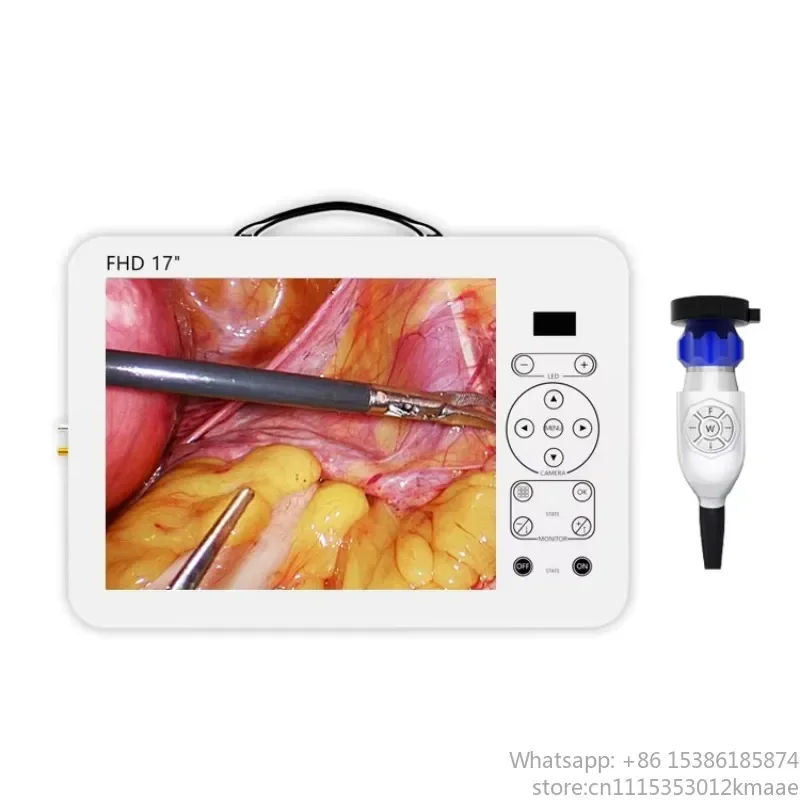 Portable All-in-One Endoscope Camera System for Medical Endoscopy