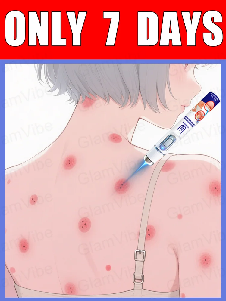 

2nd generation upgraded wart , repair warts root , ᑫuickly