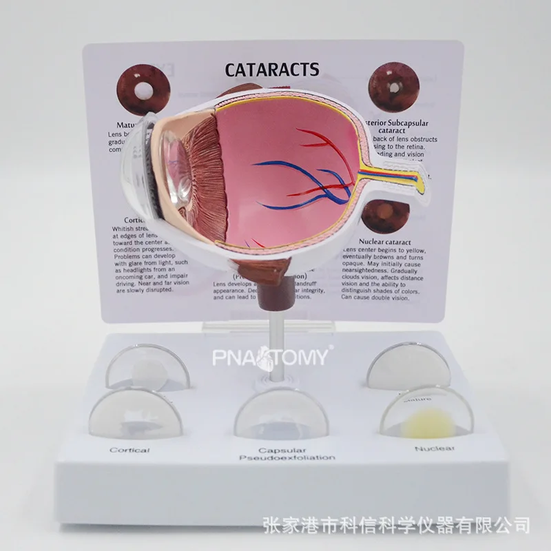 

Eyeball model Pathology Eyeball demonstration Teaching AIDS Ophthalmic display gift Anatomical model of human organs