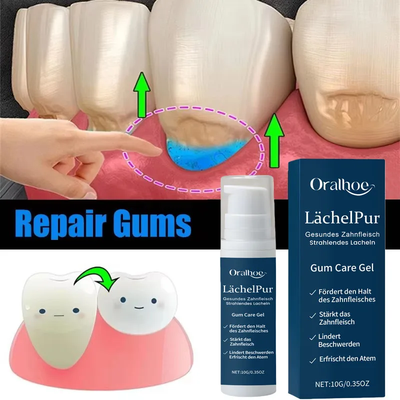 

Rapid Repair Gums Gel Effectively Relieve Tooth Allergy Dental Caries Tooth Cleaning Toothpaste Relieve Tooth Damage Serum