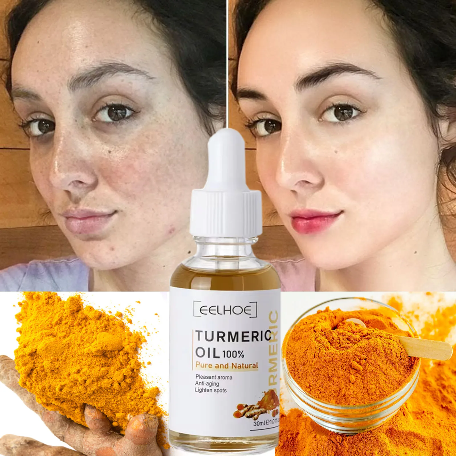 

Turmeric Whitening Freckle Serum Fade Dark Spot Pigment Melanin Correcting Moisturiz Brighten Anti-aging Face Skin Care Products