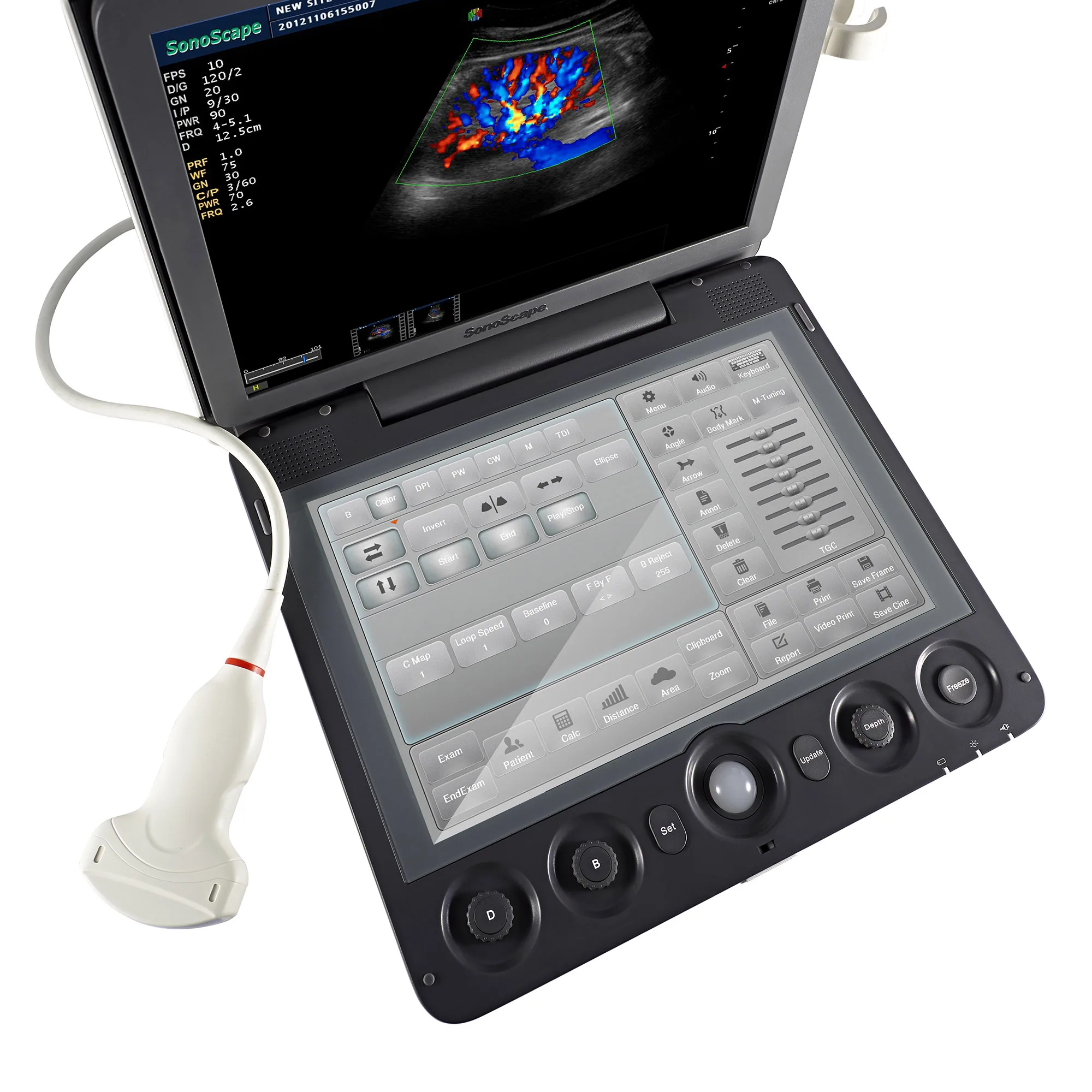 Amain Factory Sonoscape S9 4D touch screen Color Doppler  Comprehensive animal and human organs medical ultrasound instruments