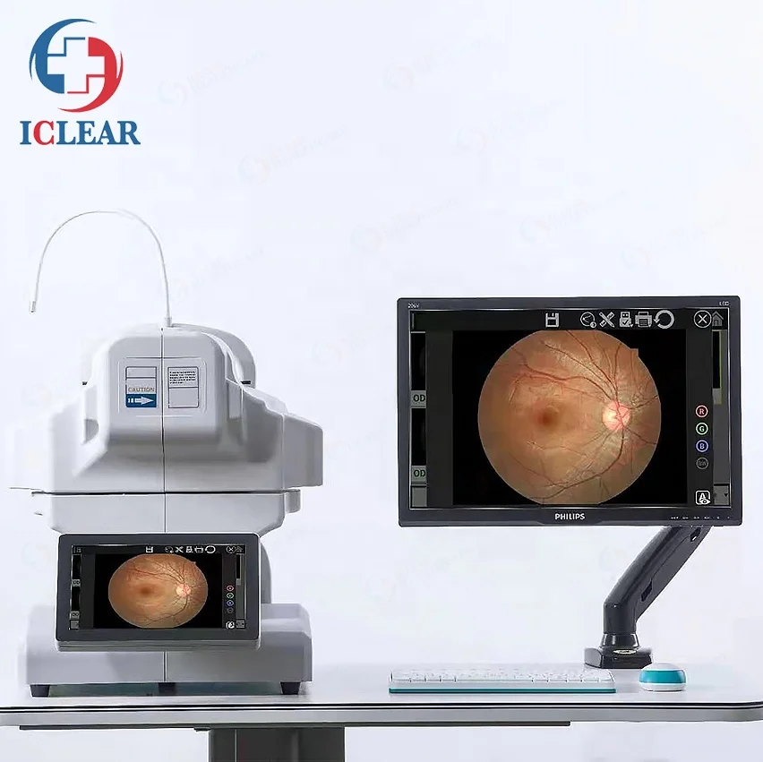 China 3D Hr Digital Automatic Non-Mydriatic Fundus Camera with FFA/FAF