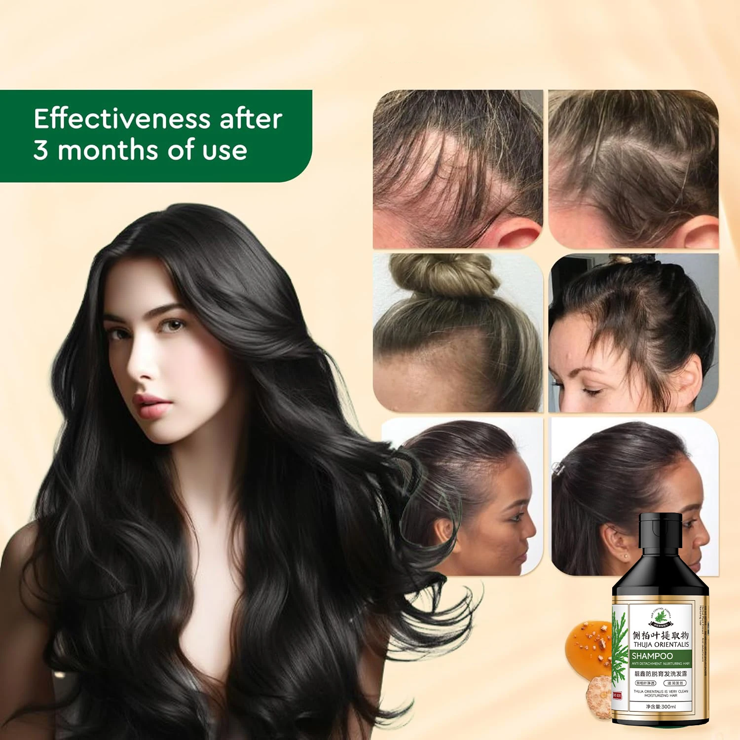 300 مللي هونغ كونغ ثوجا أوريناليس شامبو نمو الشعر لتخفيف الشعر لعلاج الشعر الرمادي السميك يمنع تساقط الشعر #6