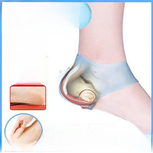 copertura-protettiva-in-silicone-per-la-protezione-del-tallone-da-screpolature-idratante-ammortizzante-morbida-e-confortevole-accessorio-per-la-protezione-delle-gambe