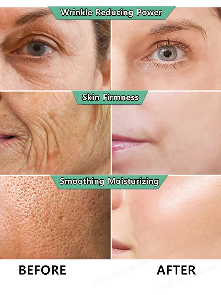 Anti Wrinkle Aging Instant Effect Remove Facial Wrinkles