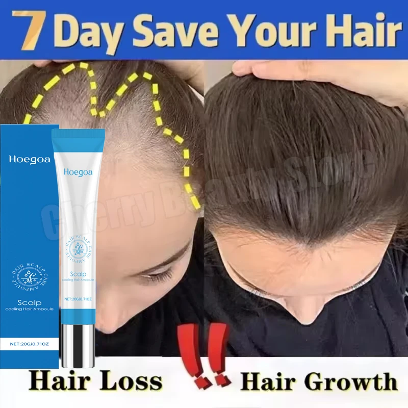 

Сыворотка для быстрого роста волос, эфирное масло для роста волос, против выпадения волос, восстановление поврежденной кожи головы, для женщин и мужчин, против облысения, уход за ростом волос