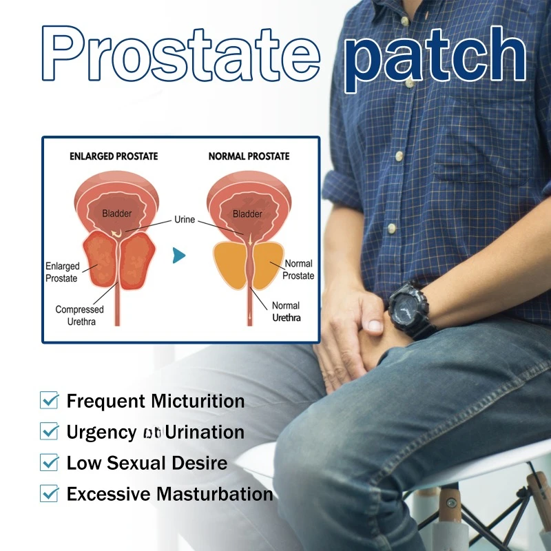 Patch para o umbigo da próstata para homens, Tratamento de prostatite Medicina de gesso, Urologia Prostatic Acupoint Sticker, Cuidados de saúde