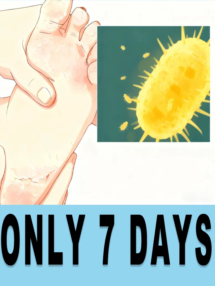 Gᴇᴛ Rɪᴅ ᴏғ Pᴇᴇʟɪɴɢ Aɴᴅ ɪᴛᴄʜʏ ғᴇᴇᴛ,Step into Comfort