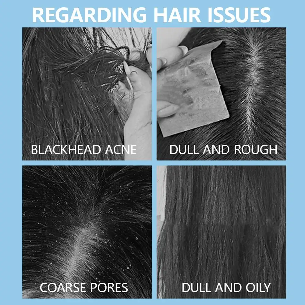 

Thorough Шампунь против перхоти с дисульфидом селена, контроль жирности, питательный освежающий шампунь против перхоти, 300 мл, против зуда S Q0Q6