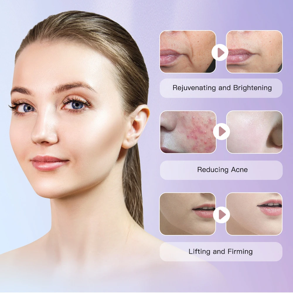 Face Lifter V-Line Up Cintura per il lifting del viso Viso dimagrante EMS Massaggiatore facciale Strumento di bellezza del viso Anti invecchiamento Bellezza delle rughe