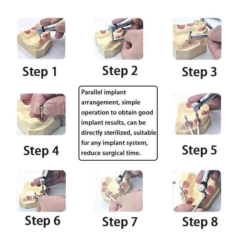 Dental implant Para Drill Aid Guide Tool Oral Parallel Dentistry Implantation Position Locator Tools Dentist Instruments