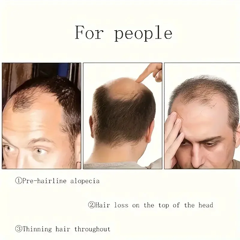 Men Wig Male Bald Patch Hairpiece Overhead Replacement Block Invisible Seamless Toupee Hair for Men Anti-Wind Clip