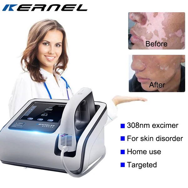 Kernel 308nm 311nm uvb lamp vitiligo psoriasis excimer system laser therapy violet device for treating vitiligo psoriasis