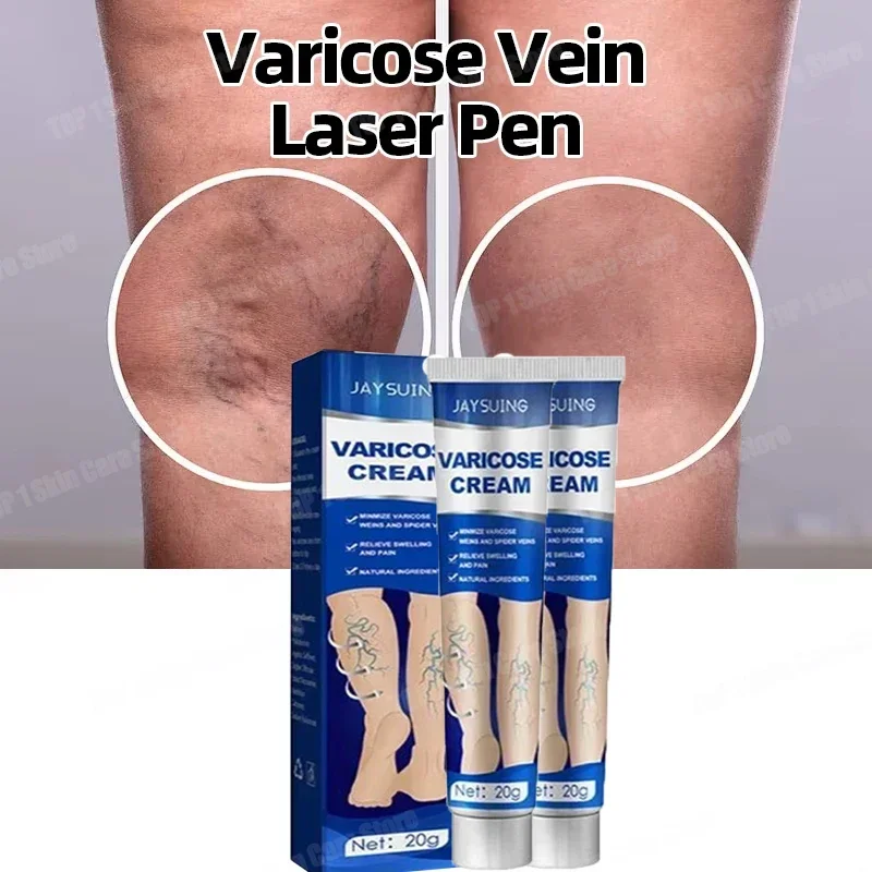 

Varicose vein remover effectively relieves leg pain, suitable for adults and the elderly