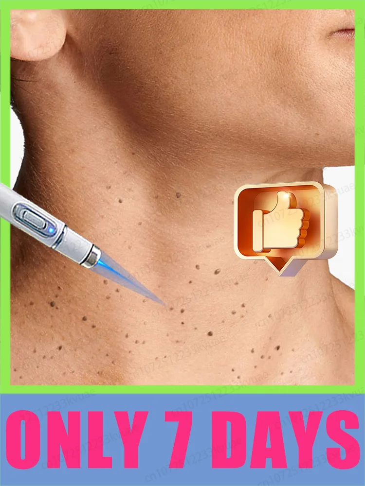 ᴳᵉⁿᵉʳᵃᵗⁱᵒⁿ⁻² ᴸᵃˢᵉʳ ᔆᵃʸˢ ᴳᵒᵒᵈᵇʸᵉ ᵀᵒ ᵃˡˡ ʷᵃʳᵗˢ ᴵⁿ ⁷ ᴰᵃʸˢ