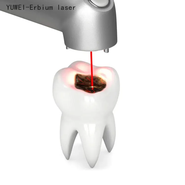 Welding Machine  and Orthodontic YAG Spot Welder for Denture Repair Erbium Er Yag