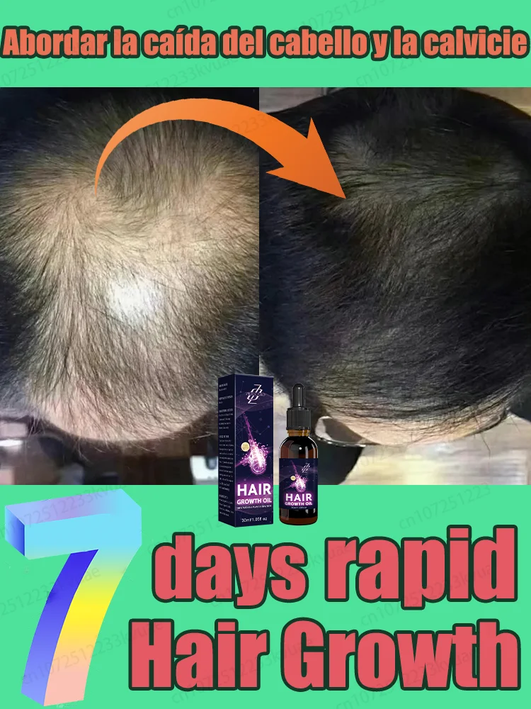 

It only takes 7 days to turn baldness into thick hair