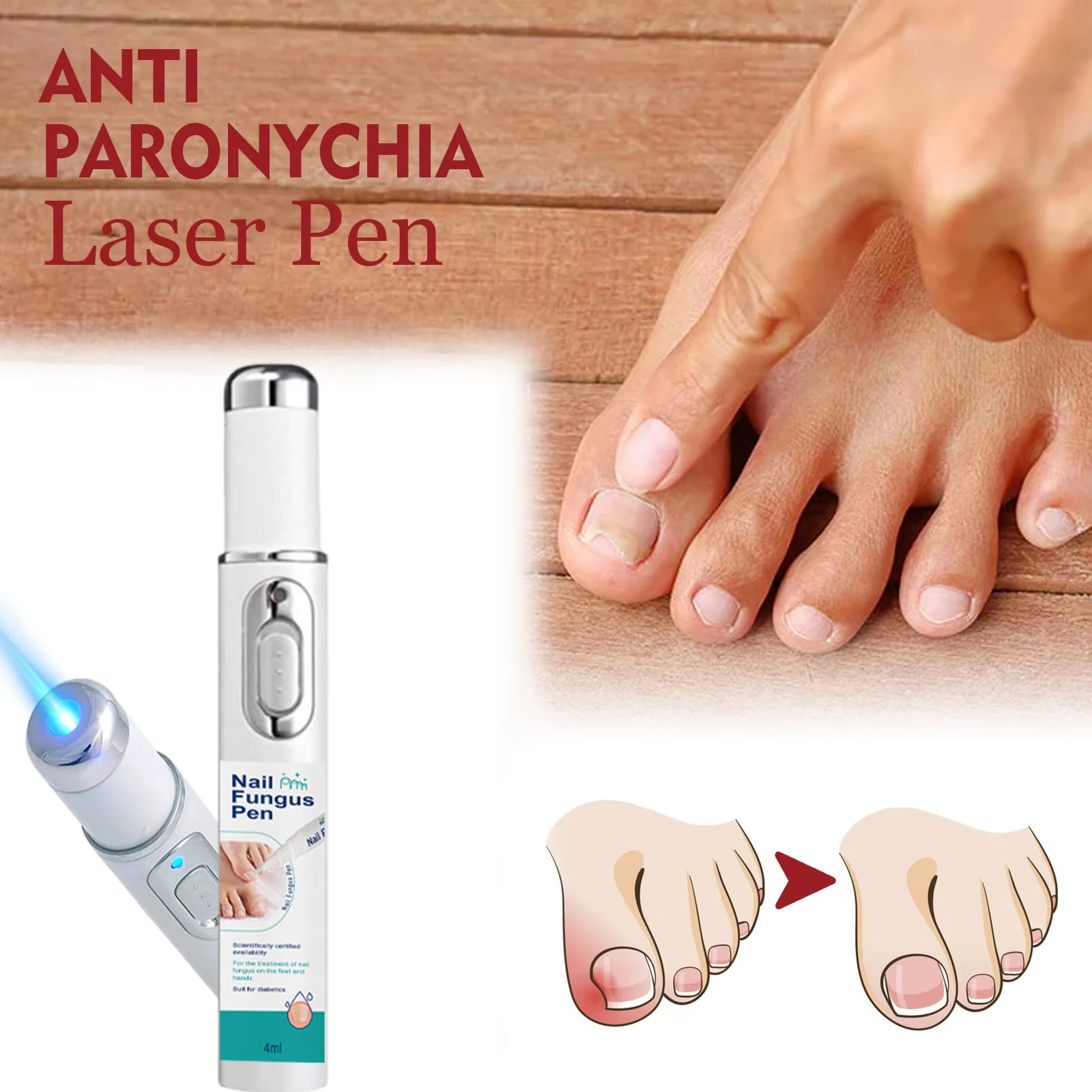 

Nail Fungus Laser Pen Blue Light Therapy laser pen for Foot Care