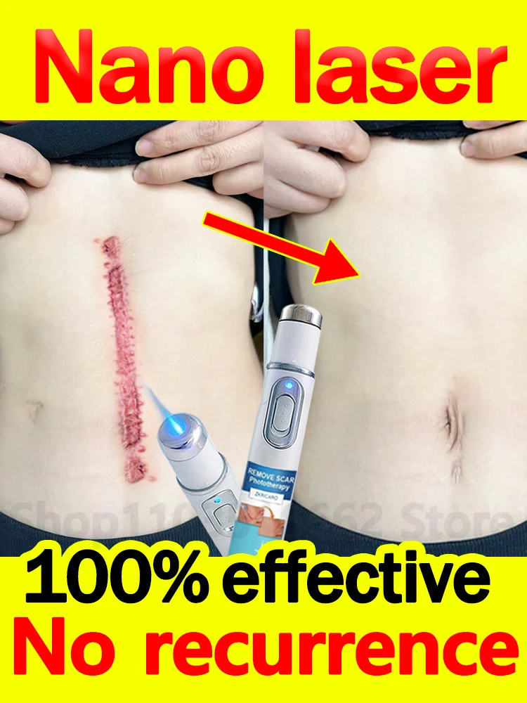 nano laser solve scar problem