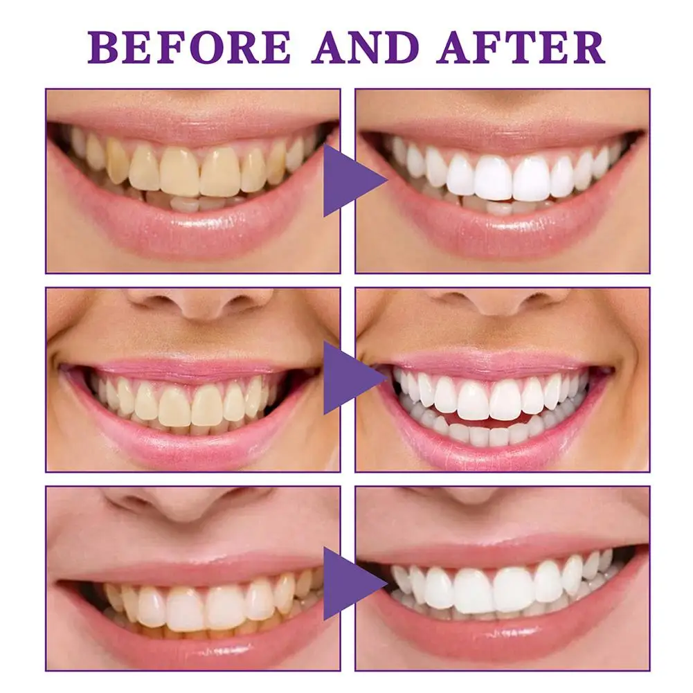 30ml Teeth Whitening Toothpaste V34 Color Tooth Correction Whitener Teeth Purple Non-Invasive Whitening Toothpaste Gum Oral Care