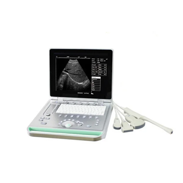 Medical UItrasound Instruments Laptop Ultrasound Machine B/W Portable Ultrasound Scanner