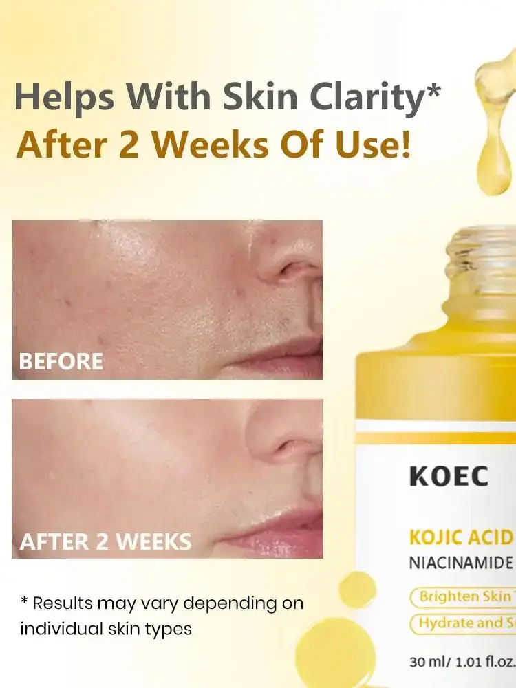 KOEC – sérum Niacinamide au curcuma, acide kojique, hydratant, lissant, éclaircissant, améliore la clarté de la peau, formule naturelle Anti-âge, 30ml