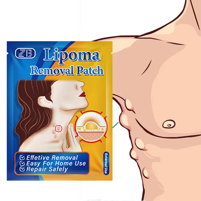 6Pcs Lipoma Remove Patch Herb Anti-Tumor Fat Mass Swelling Pain Stickers Body Hard Block Relief Health Care Medicine Plaster