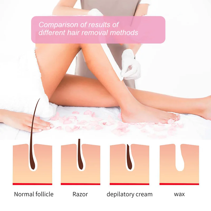 Portable Handheld Electric Heating Wax Machine Body Hair Removal Kerotherapy Hot Wax Roller Chest Arm