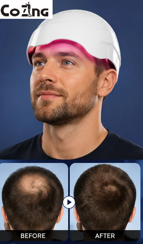 Red Light Hair Growth Cap  Infrared Anti-hair Loss Therapy Device Prevents Hair Loss and Promotes Scalp Blood Circulation